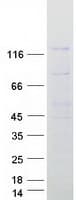 Human NUP133 Protein (Recombinant Myc-DDK (Flag))