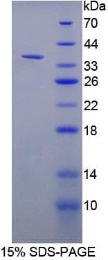 Rat NT5C3A Protein (Recombinant His-T7)