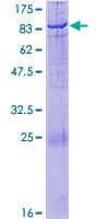 Human PRKAA2 / AMPK Alpha 2 Protein (Recombinant GST)