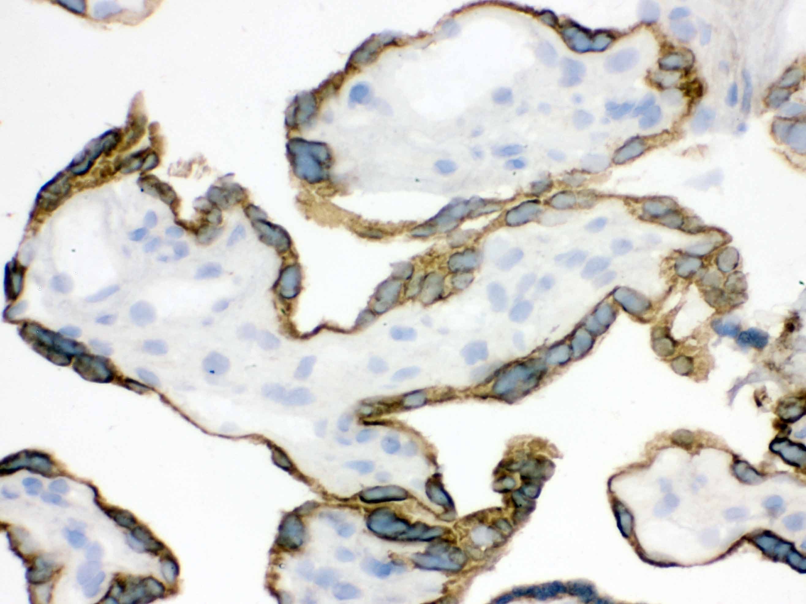 Polyclonal Rabbit anti-Human ZP2 Antibody (aa511-544, IHC, WB)