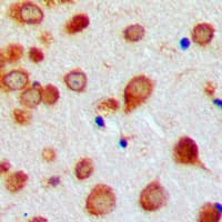 BMP7 Antibody (Internal)