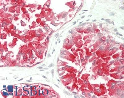 PathPlus™ FOLH1 / PSMA Antibody (clone 9E6)