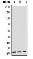 SARA2 / SAR1B Antibody (Internal)