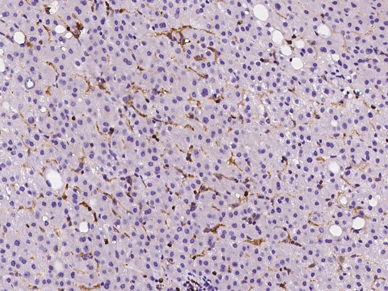 SLC40A1 / Ferroportin-1 Antibody