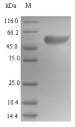 Human IFI6 / G1P3 Protein (Recombinant 6His-B2M, N-terminus)