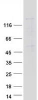 Human ESET / SETDB1 Protein (Recombinant Myc-DDK (Flag))