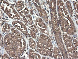 Monoclonal Mouse anti-Human UBE2J1 Antibody (clone OTI3C11, IHC, WB)