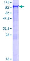 Human KIAA0828 / AHCYL2 Protein (Recombinant GST)