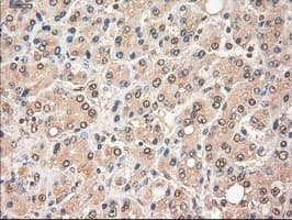Monoclonal Mouse anti-Human MYC / c-Myc Antibody (clone OTI1A6, IHC, IF, WB)