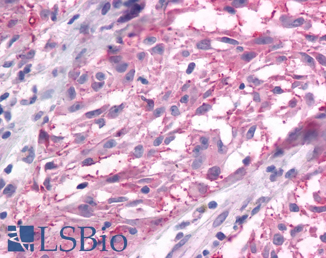 PathPlus™ GRM3 / MGLUR3 Antibody (N-Terminus)