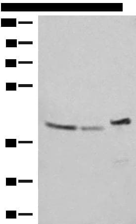 ERAL1 Antibody