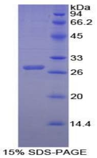 Human CTH / Cystathionase Protein (Recombinant His-T7)