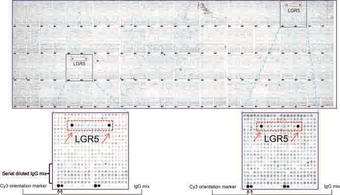 GPR49 / LGR5 Antibody (aa22-543, clone UMAB211)