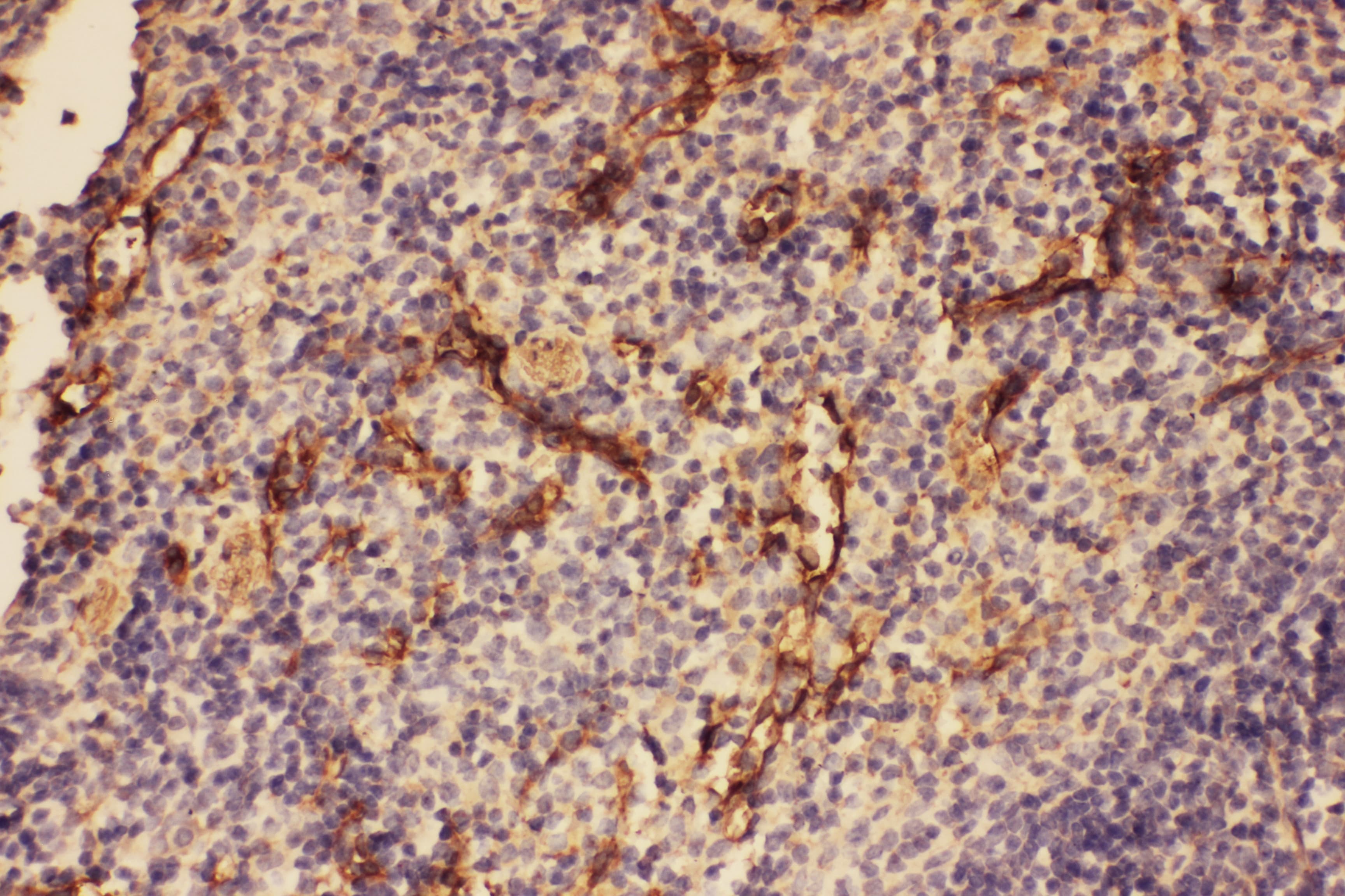Complement C5 Antibody (aa1-18)