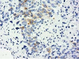 LIN7B Antibody (clone OTI1C9)