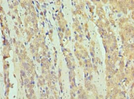 Polyclonal Rabbit anti-Human SMARCB1 / INI1 Antibody (aa86-385, IHC, WB)