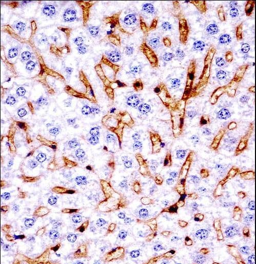 MAPK11 / SAPK2 / p38 Beta Antibody (aa1-30)