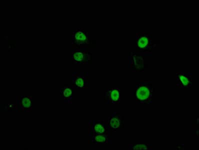 Polyclonal Rabbit anti-Human TFAP2C / AP2 Gamma Antibody (IHC)