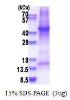 Human HP / Haptoglobin Protein (Recombinant His)