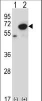 PNKP Antibody (aa109-138)