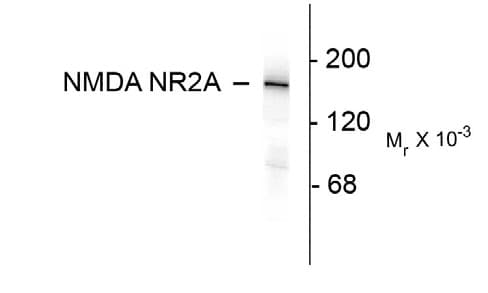 GRIN2A / NMDAR2A / NR2A Antibody (C-Terminus)