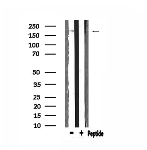BCOR Antibody