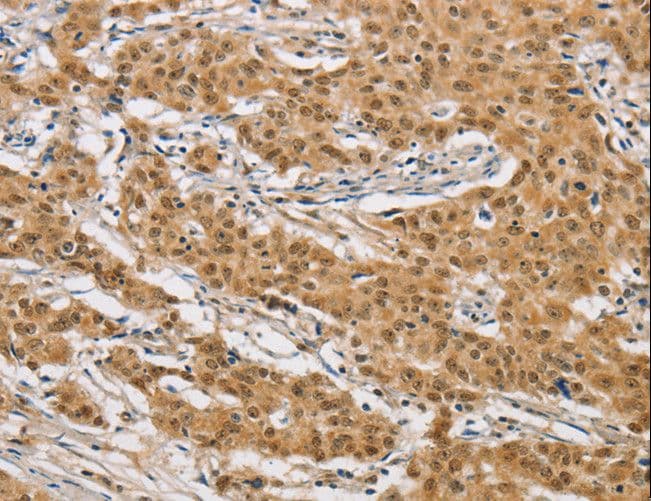ARHGAP25 Antibody