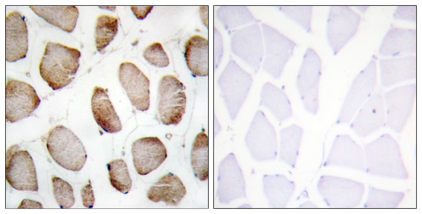 DUS2 / DUS2L Antibody (aa421-470)