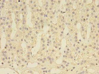 DENND1A Antibody