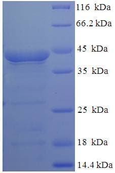 Mycoplasma Modification Methylase MunI Protein (Recombinant His-SUMO)