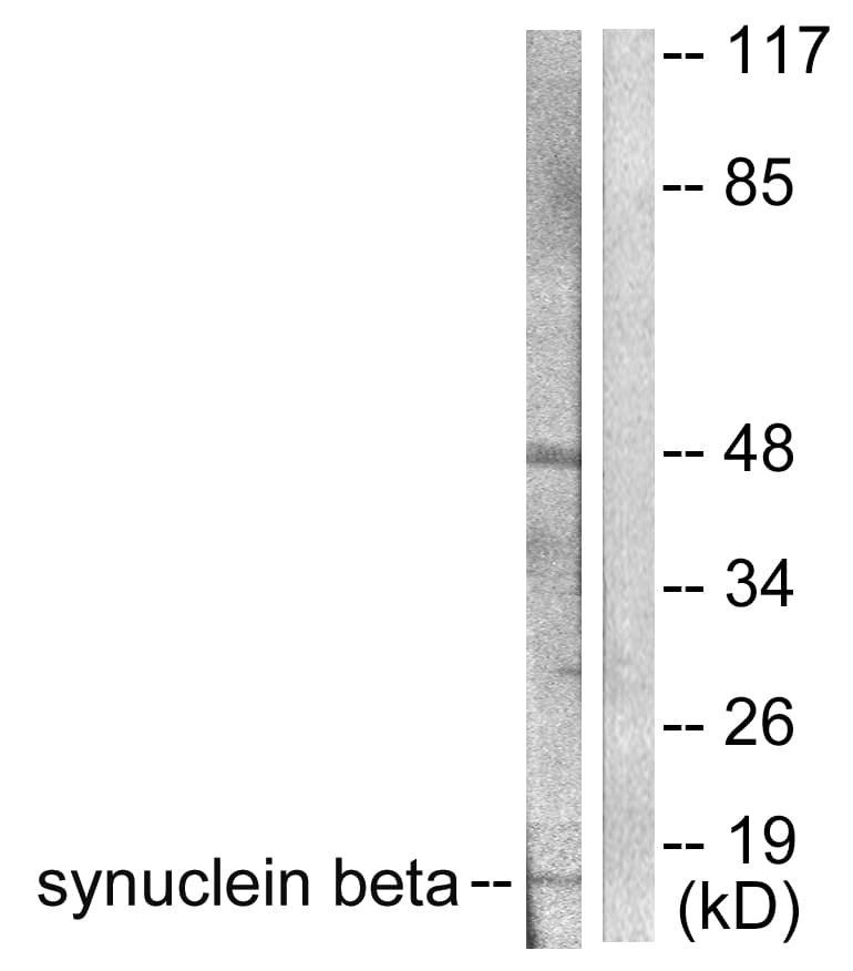 IHC-plus™ SNCB / Beta-Synuclein Antibody (aa85-134)