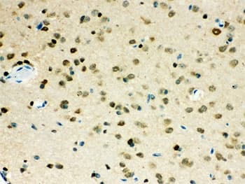 VCP Antibody (aa732-760)