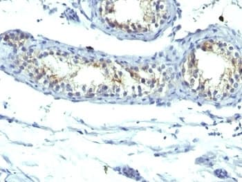 PRLR / Prolactin Receptor Antibody (clone B6.2 + PRLR742)
