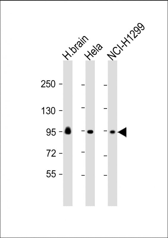 GALC / Galactocerebrosidase Antibody (N-Terminus)
