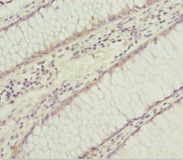 Polyclonal Rabbit anti-Human SOCS4 Antibody (IHC, WB)