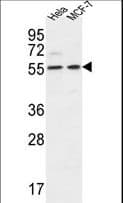 Polyclonal Rabbit anti-Human DDX6 Antibody (aa348-375, IHC, WB)