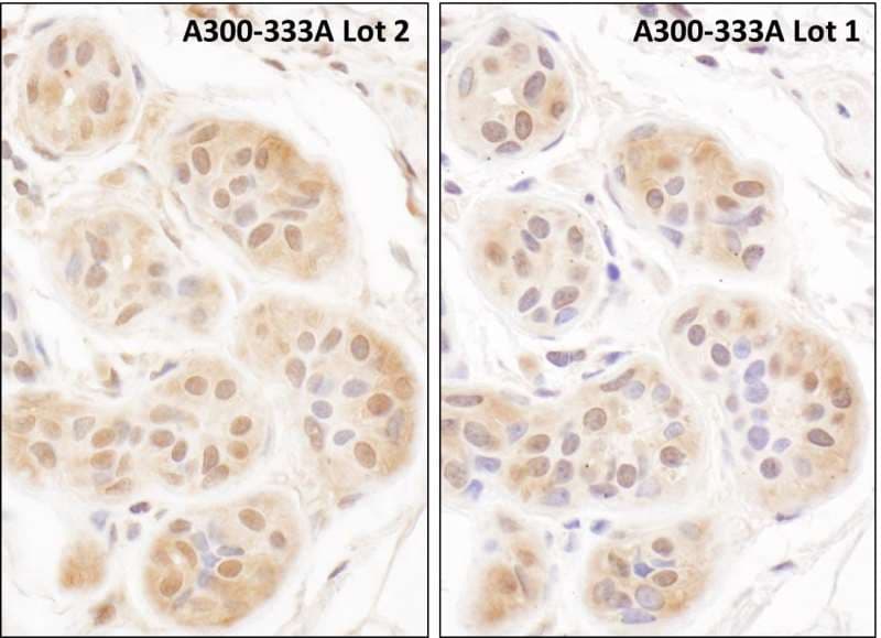 FHL2 Antibody (aa225-C-term)