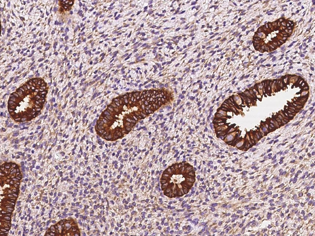 STX18 / Syntaxin 18 Antibody