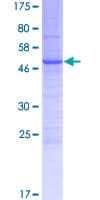 Human LY6K Protein (Recombinant GST)
