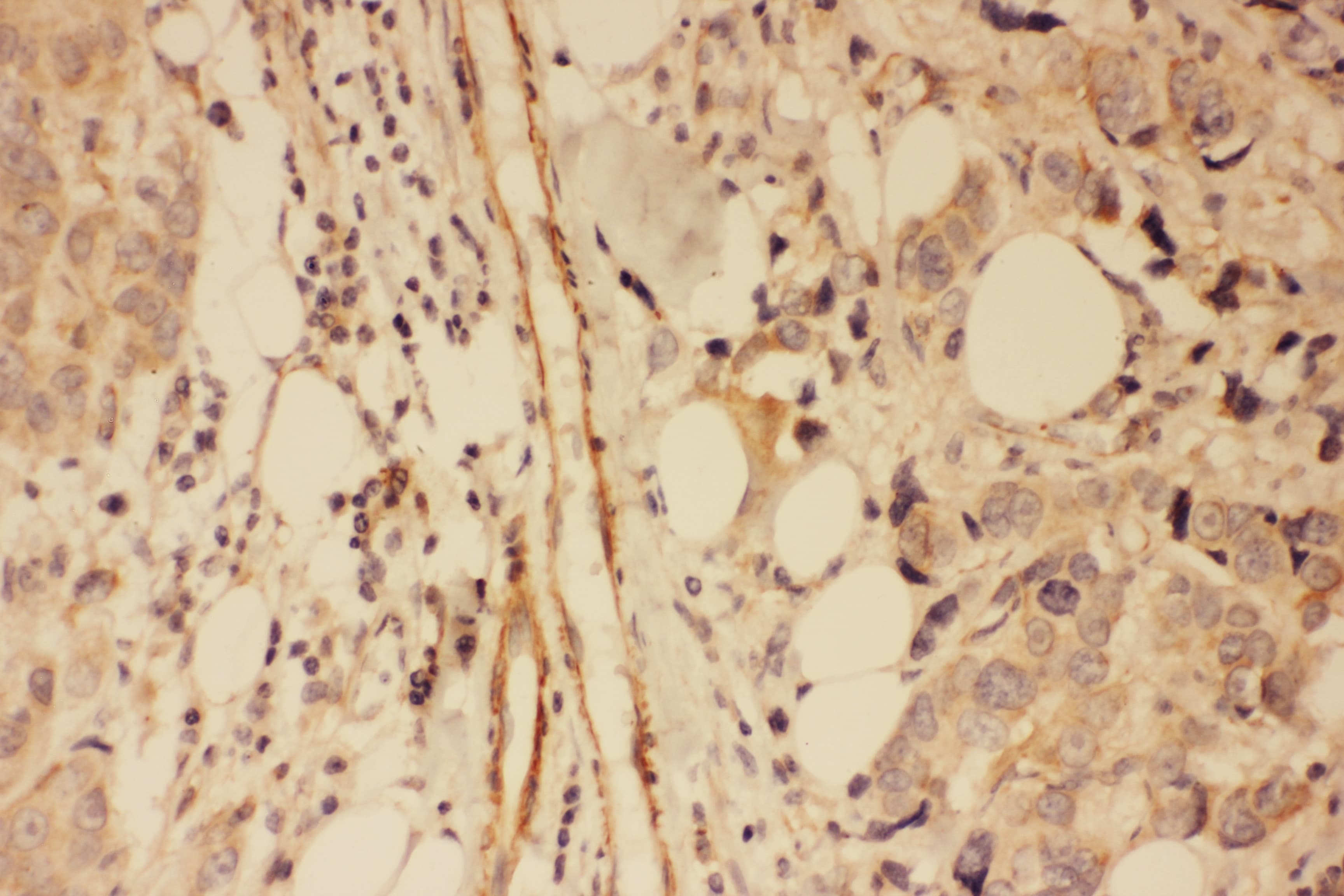 DLG4 / PSD95 Antibody (aa492-507)