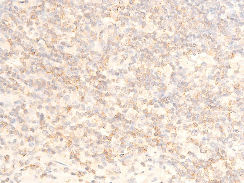 Polyclonal Rabbit anti-Human NFKBIA / IKB Alpha / IKBA Antibody (phospho-Ser32,phospho-Ser36, IHC, IF, WB)