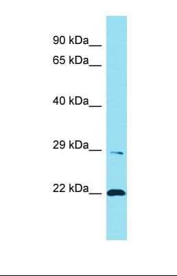 Polyclonal Rabbit anti-Human LENG1 Antibody (aa172-221, WB)