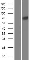DDN / Dendrin Protein (Over-Expression Lysate Myc-DDK (Flag))