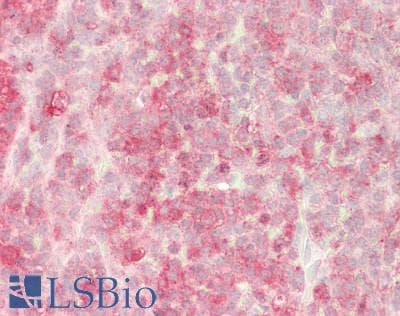 IHC-plus™ Polyclonal Rabbit anti-Human PRKAR1A Antibody (IHC, IF, WB)