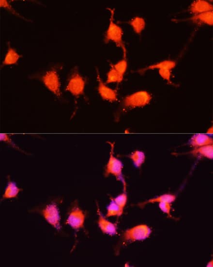 NGF Antibody