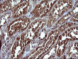 SERPINB3 Antibody (clone OTI1A12)