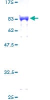 Human ZNF207 Protein (Recombinant GST)