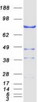 Human NEK11 Protein (Recombinant Myc-DDK (Flag))