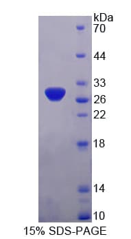 Human PDHX / Protein X / ProX (Recombinant His-T7)