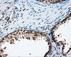 LIPG / Endothelial Lipase Antibody (clone OTI4A8)